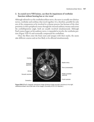 Cranial nerves  