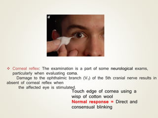  Corneal reflex: The examination is a part of some neurological exams,
particularly when evaluating coma.
Damage to the ophthalmic branch (V1) of the 5th cranial nerve results in
absent of corneal reflex when
the affected eye is stimulated.
Touch edge of cornea using a
wisp of cotton wool
Normal response = Direct and
consensual blinking
 