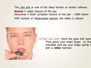 The Jaw jerk is one of the deep tendon or stretch reflexes.
Normal = slight closure of the jaw
Abnormal = brisk complete closure of the jaw – UMN lesion
With nuclear or Infranuclear lesions, the reflex is absent.
 Test Jaw Jerk: Have the jaws half open
Then place your index finger on the
mandible and tap your finger gently b
with a reflex hammer.
 