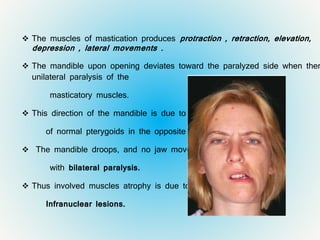  The muscles of mastication produces protraction , retraction, elevation,
depression , lateral movements .
 The mandible upon opening deviates toward the paralyzed side when ther
unilateral paralysis of the
masticatory muscles.
 This direction of the mandible is due to the action
of normal pterygoids in the opposite side.
 The mandible droops, and no jaw movement is possible
with bilateral paralysis.
 Thus involved muscles atrophy is due to Nuclear or
Infranuclear lesions.
 