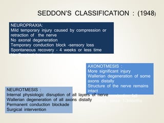 NEUROPRAXIA:
Mild temporary injury caused by compression or
retraction of the nerve
No axonal degeneration
Temporary conduction block -sensory loss
Spontaneous recovery – 4 weeks or less time
No Surgical Intervention
SEDDON’S CLASSIFICATION : (1948)
AXONOTMESIS :
More significant injury
Wallerian degeneration of some
axons distally
Structure of the nerve remains
intact
Prolonged conduction fail
Recovery takes 1-3months
NEUROTMESIS :
Internal physiologic disruption of all layers of nerve
Wallerian degeneration of all axons distally
Permanent conduction blockade
Surgical intervention
 