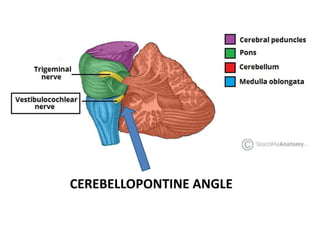 CEREBELLOPONTINE ANGLE
 