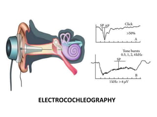 ELECTROCOCHLEOGRAPHY
 