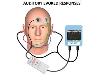 AUDITORY EVOKED RESPONSES
 