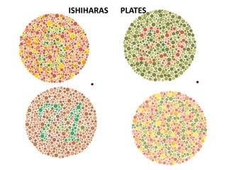 ISHIHARAS PLATES
 