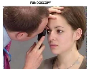 FUNDOSCOPY
 