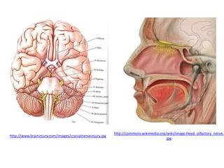 http://commons.wikimedia.org/wiki/Image:Head_olfactory_nerve.
jpg
http://www.braininjury.com/images/cranialnerveinjury.jpg
 