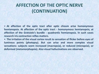 AFFECTION OF THE OPTIC NERVE
(CONTINUATION)
• At affection of the optic tract after optic chiasm arise homonymous
hemianopsia. At affection of the optic tract - homonymous hemianopsia, at
affection of the Gratsiole's bundle - quadrantic hemianopsia. In such cases
research iris contraction reflex matters.
• The irritation of the visual cortex result to sensation of flicker before eyes of
luminous points (photopsy). But can arise and more complex visual
sensations: subjects seem increased (macropsia), or reduced (micropsia), or
deformed (metamorphopsia). Also visual hallucinations are observed.
 