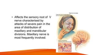 TRIGEMINAL NEURALGIA
• Affects the sensory root of V
nerve characterised by
attacks of severe pain in the
area of distribution of
maxillary and mandibular
divisions. Maxillary nerve is
most frequently involved.
 