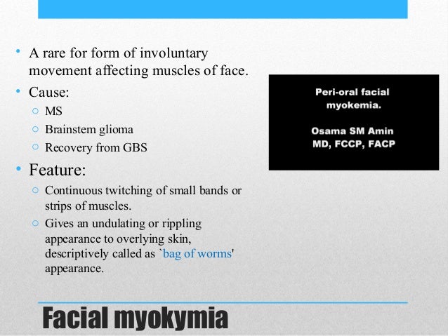 Does Rippling Muscle Disease Hurt