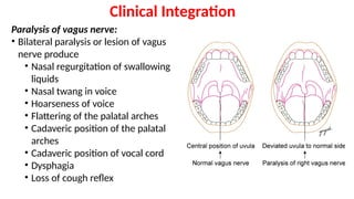 Anatomy of Cranial Nerves IX - X - XI - XII.pptx
