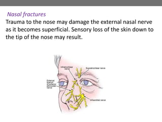 Nasal fractures
Trauma to the nose may damage the external nasal nerve
as it becomes superficial. Sensory loss of the skin down to
the tip of the nose may result.
 