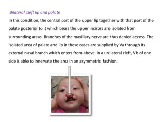 Bilateral cleft lip and palate
In this condition, the central part of the upper lip together with that part of the
palate posterior to it which bears the upper incisors are isolated from
surrounding areas. Branches of the maxillary nerve are thus denied access. The
isolated area of palate and lip in these cases are supplied by Va through its
external nasal branch which enters from above. In a unilateral cleft, Vb of one
side is able to innervate the area in an asymmetric fashion.
 