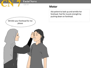 Ask patient to look up and wrinkle her
forehead. Feel for muscle strength by
pushing down on forehead.
Motor
Wrinkle your forehead for me
please
CN 7 Facial Nerve
CN VII
 