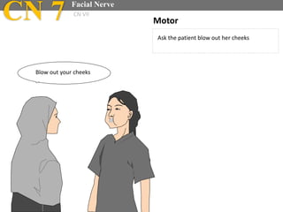 Ask the patient blow out her cheeks
Motor
Blow out your cheeks
CN 7 Facial Nerve
CN VII
 