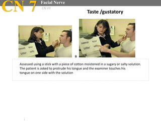Assessed using a stick with a piece of cotton moistened in a sugary or salty solution.
The patient is asked to protrude his tongue and the examiner touches his
tongue on one side with the solution
Taste /gustatoryCN 7 Facial Nerve
CN VII
 