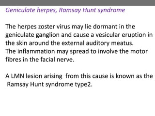 Geniculate herpes, Ramsay Hunt syndrome
The herpes zoster virus may lie dormant in the
geniculate ganglion and cause a vesicular eruption in
the skin around the external auditory meatus.
The inflammation may spread to involve the motor
fibres in the facial nerve.
A LMN lesion arising from this cause is known as the
Ramsay Hunt syndrome type2.
 