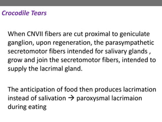 Crocodile Tears
When CNVII fibers are cut proximal to geniculate
ganglion, upon regeneration, the parasympathetic
secretomotor fibers intended for salivary glands ,
grow and join the secretomotor fibers, intended to
supply the lacrimal gland.
The anticipation of food then produces lacrimation
instead of salivation  paroxysmal lacrimaion
during eating
 