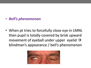 • Bell’s phenomenon
• When pt tries to forcefully close eye in LMNL
then pupil is totally covered by brisk upward
movement of eyeball under upper eyelid 
blindman’s appearance / bell’s phenomenon
 