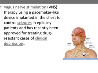 • Vagus nerve stimulation (VNS)
therapy using a pacemaker-like
device implanted in the chest to
control seizures in epilepsy
patients and has recently been
approved for treating drug-
resistant cases of clinical
depression..
 