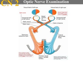 Optic canal
CN 2 Optic Nerve ExaminationCN II
 