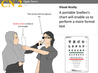 Snellen chart is hold at
arm-length
A portable Snellen’s
chart will enable us to
perform a more formal
test
Visual AcuityCN 2Optic Nerve
CN II
Test acuity with her glasses
on.
 