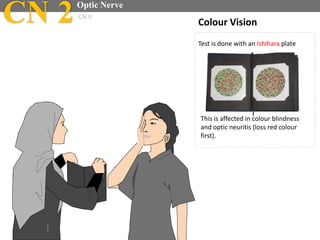 This is affected in colour blindness
and optic neuritis (loss red colour
first).
CN 2Optic Nerve
CN II
Colour Vision
Test is done with an Ishihara plate
 