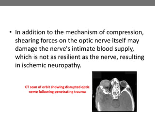 • In addition to the mechanism of compression,
shearing forces on the optic nerve itself may
damage the nerve's intimate blood supply,
which is not as resilient as the nerve, resulting
in ischemic neuropathy.
CT scan of orbit showing disrupted optic
nerve following penetrating trauma
 