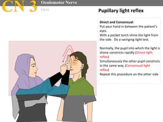 Pupillary light reflex
Direct and Consensual:
Put your hand in between the patient’s
eyes.
With a pocket torch shine the light from
the side. Do a swinging-light test.
Normally, the pupil into which the light is
shone constricts rapidly (Direct light
reflex)
Simultaneously the other pupil constricts
in the same way, (Consensual light
reflex)
Repeat this procedure on the other side
CN 3 Oculomotor Nerve
CN III
 