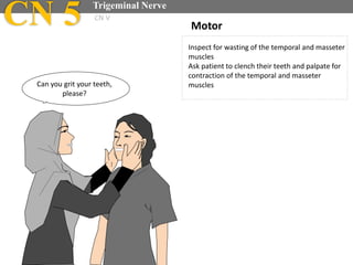 Inspect for wasting of the temporal and masseter
muscles
Ask patient to clench their teeth and palpate for
contraction of the temporal and masseter
muscles
Motor
Can you grit your teeth,
please?
CN 5 Trigeminal Nerve
CN V
 