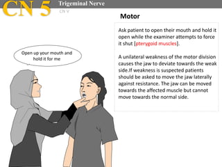Ask patient to open their mouth and hold it
open while the examiner attempts to force
it shut [pterygoid muscles].
A unilateral weakness of the motor division
causes the jaw to deviate towards the weak
side.If weakness is suspected patients
should be asked to move the jaw laterally
against resistance. The jaw can be moved
towards the affected muscle but cannot
move towards the normal side.
Motor
Open up your mouth and
hold it for me
CN 5 Trigeminal Nerve
CN V
 