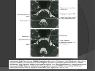Cranial nerves anatomy & pathology | PPTX