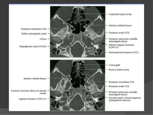Cranial nerves anatomy & pathology