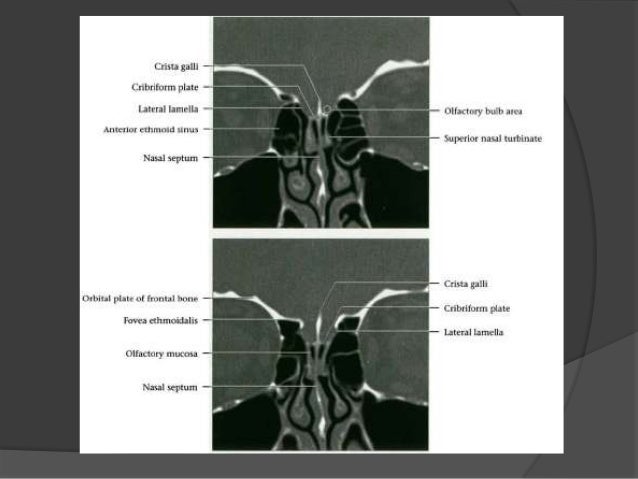 Cranial nerves anatomy & pathology