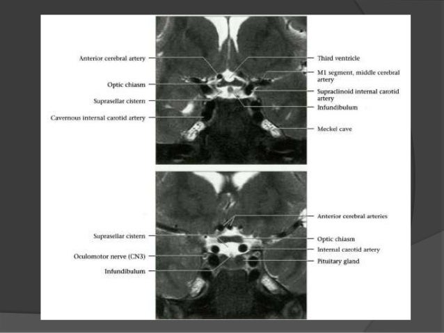 Cranial nerves anatomy & pathology