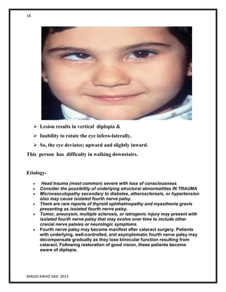 18
MAGDI AWAD SASI 2013
 Lesion results in vertical diplopia &
 Inability to rotate the eye infero-laterally.
 So, the eye deviates; upward and slightly inward.
This person has difficulty in walking downstairs.
Etiology-
Head trauma (most common) severe with loss of consciousness.
Consider the possibility of underlying structural abnormalities IN TRAUMA
Microvasculopathy secondary to diabetes, atherosclerosis, or hypertension
also may cause isolated fourth nerve palsy.
There are rare reports of thyroid ophthalmopathy and myasthenia gravis
presenting as isolated fourth nerve palsy.
Tumor, aneurysm, multiple sclerosis, or iatrogenic injury may present with
isolated fourth nerve palsy that may evolve over time to include other
cranial nerve palsies or neurologic symptoms.
Fourth nerve palsy may become manifest after cataract surgery. Patients
with underlying, well-controlled, and asymptomatic fourth nerve palsy may
decompensate gradually as they lose binocular function resulting from
cataract. Following restoration of good vision, these patients become
aware of diplopia.
 