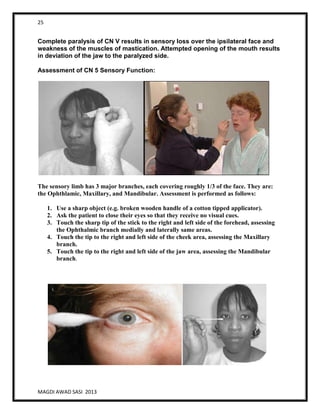 25
MAGDI AWAD SASI 2013
Complete paralysis of CN V results in sensory loss over the ipsilateral face and
weakness of the muscles of mastication. Attempted opening of the mouth results
in deviation of the jaw to the paralyzed side.
Assessment of CN 5 Sensory Function:
The sensory limb has 3 major branches, each covering roughly 1/3 of the face. They are:
the Ophthlamic, Maxillary, and Mandibular. Assessment is performed as follows:
1. Use a sharp object (e.g. broken wooden handle of a cotton tipped applicator).
2. Ask the patient to close their eyes so that they receive no visual cues.
3. Touch the sharp tip of the stick to the right and left side of the forehead, assessing
the Ophthalmic branch medially and laterally same areas.
4. Touch the tip to the right and left side of the cheek area, assessing the Maxillary
branch.
5. Touch the tip to the right and left side of the jaw area, assessing the Mandibular
branch.
 