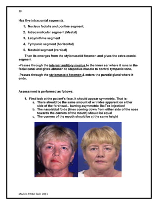 30
MAGDI AWAD SASI 2013
Has five intracranial segments:
1. Nucleus facialis and pontine segment.
2. Intracanalicular segment (Meatal)
3. Labyrinthine segment
4. Tympanic segment (horizontal)
5. Mastoid segment (vertical)
Then its emerges from the stylomasotid foramen and gives the extra-cranial
segment
-Passes through the internal auditory meatus to the inner ear where it runs in the
facial canal and gives abranch to stapedius muscle to control tympanic tone.
-Passes through the stylomastoid foramen & enters the parotid gland where it
ends.
Assessment is performed as follows:
1. First look at the patient's face. It should appear symmetric. That is:
a. There should be the same amount of wrinkles apparent on either
side of the forehead... barring asymmetric Bo-Tox injection!
b. The nasolabial folds (lines coming down from either side of the nose
towards the corners of the mouth) should be equal
c. The corners of the mouth should be at the same height
 