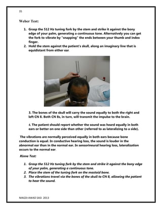 35
MAGDI AWAD SASI 2013
Weber Test:
1. Grasp the 512 Hz tuning fork by the stem and strike it against the bony
edge of your palm, generating a continuous tone. Alternatively you can get
the fork to vibrate by "snapping" the ends between your thumb and index
finger.
2. Hold the stem against the patient's skull, along an imaginary line that is
equidistant from either ear.
3. The bones of the skull will carry the sound equally to both the right and
left CN 8. Both CN 8s, in turn, will transmit the impulse to the brain.
4. The patient should report whether the sound was heard equally in both
ears or better on one side than other (referred to as lateralizing to a side).
The vibrations are normally perceived equally in both ears because bone
conduction is equal. In conductive hearing loss, the sound is louder in the
abnormal ear than in the normal ear. In sensorineural hearing loss, lateralization
occurs to the normal ear.
Rinne Test:
1. Grasp the 512 Hz tuning fork by the stem and strike it against the bony edge
of your palm, generating a continuous tone.
2. Place the stem of the tuning fork on the mastoid bone.
3. The vibrations travel via the bones of the skull to CN 8, allowing the patient
to hear the sound.
 