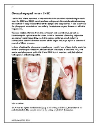 37
MAGDI AWAD SASI 2013
Glossopharyngeal nerve - CN IX
The nucleus of the nerve lies in the medulla and is anatomically indistinguishable
from the CN X and CN XI nuclei (nucleus ambiguous). Its main function is sensory
innervation of the posterior third of the tongue and the pharynx. It also innervates
the pharyngeal musculature, particularly the stylopharyngeus, in concert with the
vagus nerve.
Vascular stretch afferents from the aortic arch and carotid sinus, as well as
chemoreceptor signals from the latter, travel in the nerve of Herring to join the
glossopharyngeal nerve; they reach the nucleus solitarius, which in turn is
connected to the dorsal motor nucleus of the vagus and plays a part in the neural
control of blood pressure.
Lesions affecting the glossopharyngeal nerve result in loss of taste in the posterior
third of the tongue and loss of pain and touch sensations in the same area, soft
palate, and pharyngeal walls. CN IX and CN X travel together, and their clinical
testing is not entirely separable.
Interpretation:
If CN 9 on the right is not functioning (e.g. in the setting of a stroke), the uvula will be
pulled to the left. The opposite occurs in the setting of left CN 9 dysfunction
 