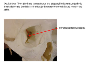 SUPERIOR ORBITAL FISSURE
Oculomotor fibers (both the somatomotor and preganglionic parasympathetic
fibers) leave the cranial cavity through the superior orbital fissure to enter the
orbit.
 