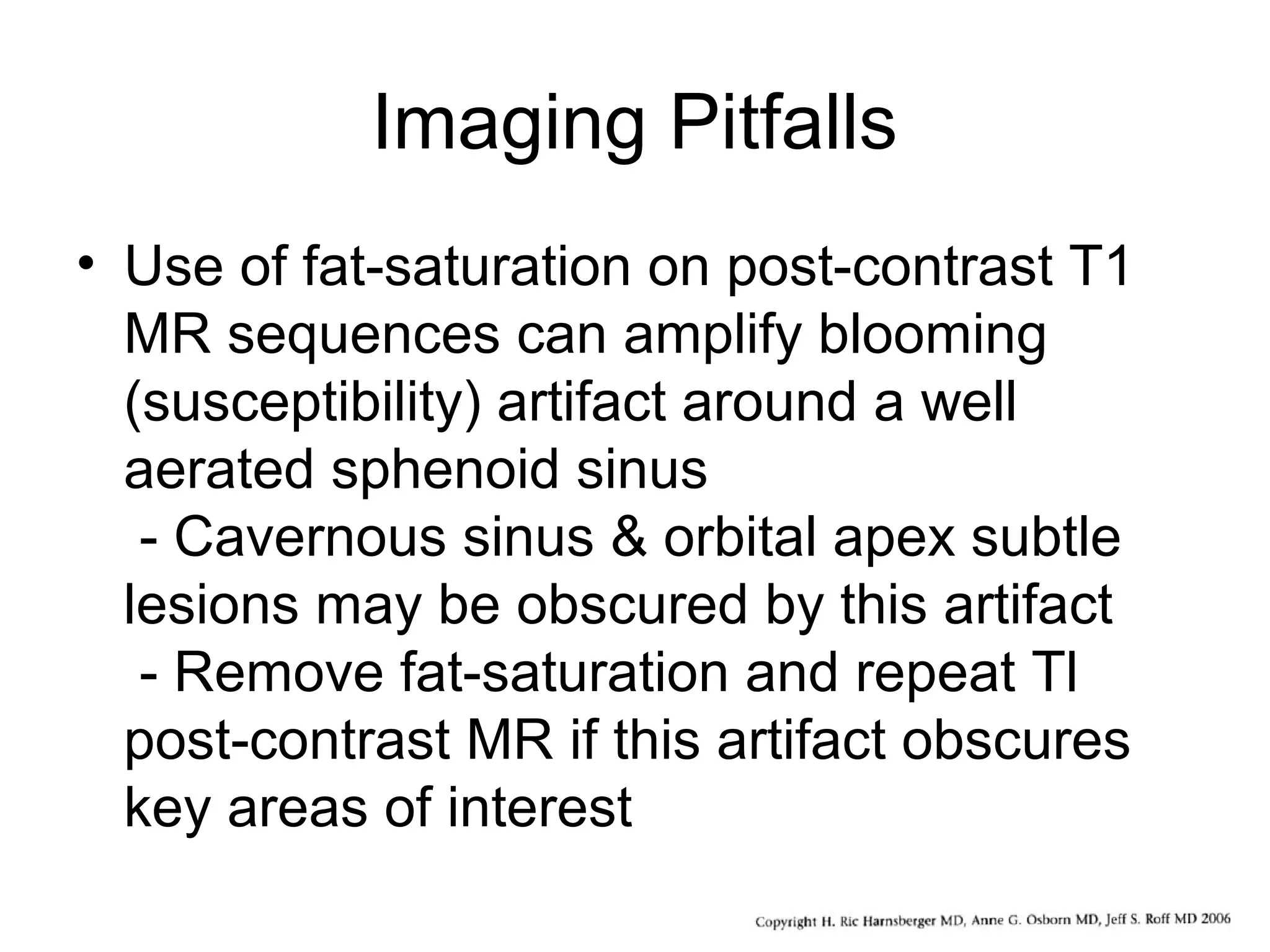 Imaging Pitfalls
• Use of fat-saturation on post-contrast T1
MR sequences can amplify blooming
(susceptibility) artifact around a well
aerated sphenoid sinus
- Cavernous sinus & orbital apex subtle
lesions may be obscured by this artifact
- Remove fat-saturation and repeat Tl
post-contrast MR if this artifact obscures
key areas of interest
 