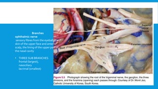 Branches
ophthalmic nerve
sensory fibres from the eyeball, the
skin of the upper face and anterior
scalp, the lining of the upper part of
the nasal cavity
• THREE SUB BRANCHES
frontal (largest),
nasociliary
lacrimal (smallest)
 