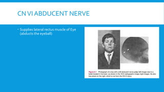 CNVI ABDUCENT NERVE
 Supplies lateral rectus muscle of Eye
(abducts the eyeball)
 