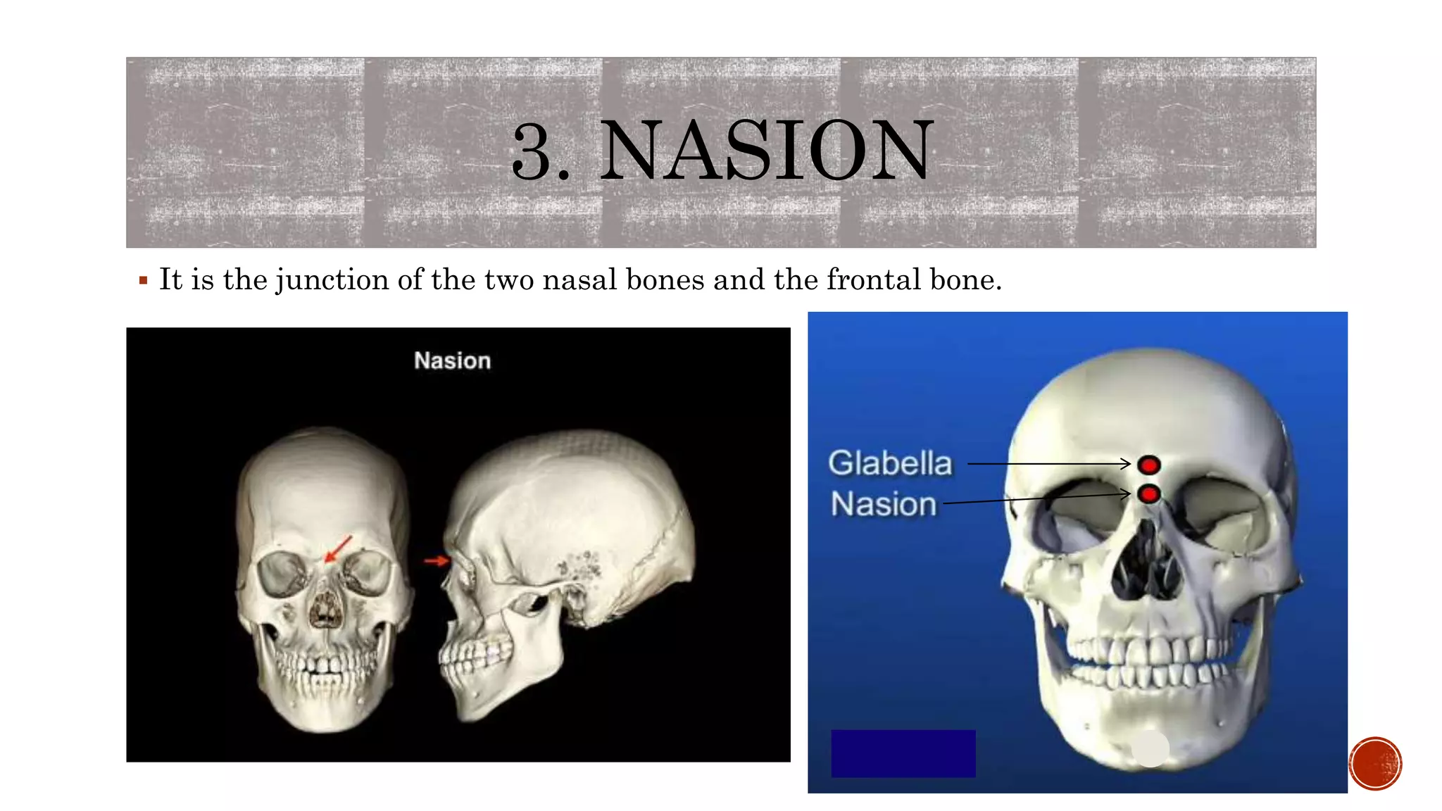 3. NASION
 It is the junction of the two nasal bones and the frontal bone.
 