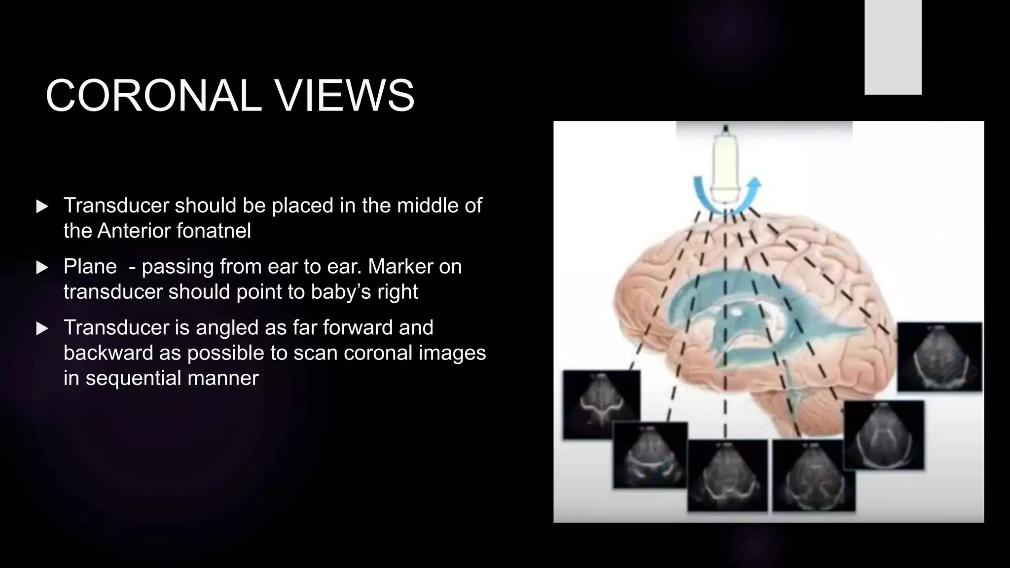 Cranial usg final.pptx