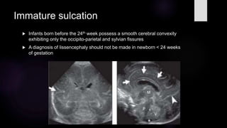Cranial usg final.pptx
