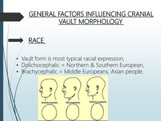 Dolichocephalic Races Cranial vault | PPTX