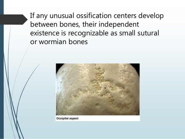 Cranial vault