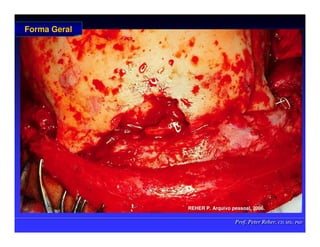 Prof. Peter Reher, CD, MSc, PhD
Prof. Peter Reher, CD, MSc, PhD
Forma Geral
Forma Geral
REHER P
REHER P.
. Arquivo
Arquivo pessoal
pessoal, 2006.
, 2006.
 